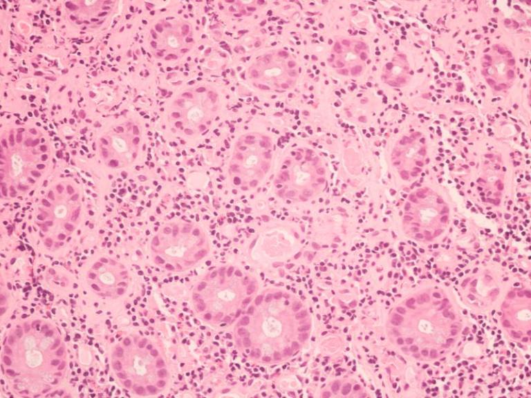 Under the microscope pink cells stock photo