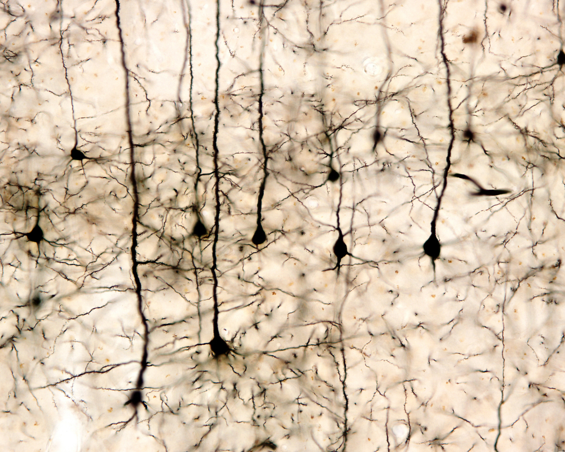 A photographic image showing a group neurons that have been stained so as to make them visible.