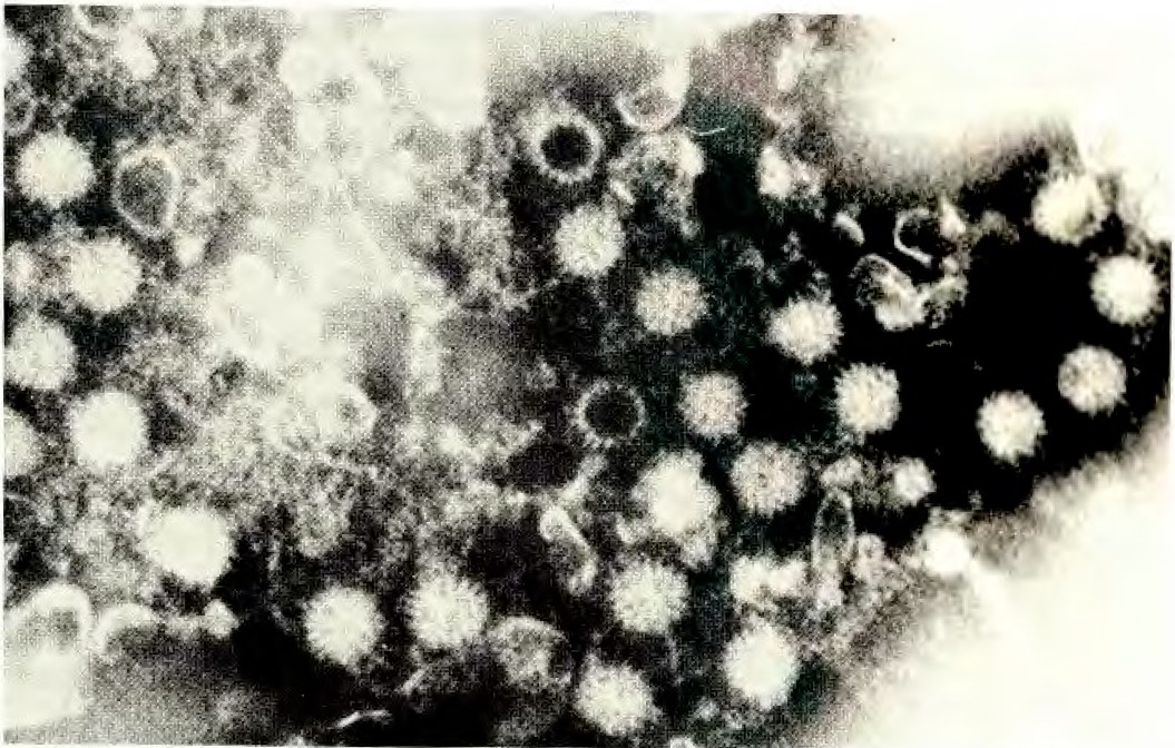 A black-and-white photographic image of human rotaviruses, originally reported by NHMRC in 1975. The rotaviruses appear in silhouette as small toothed wheels.