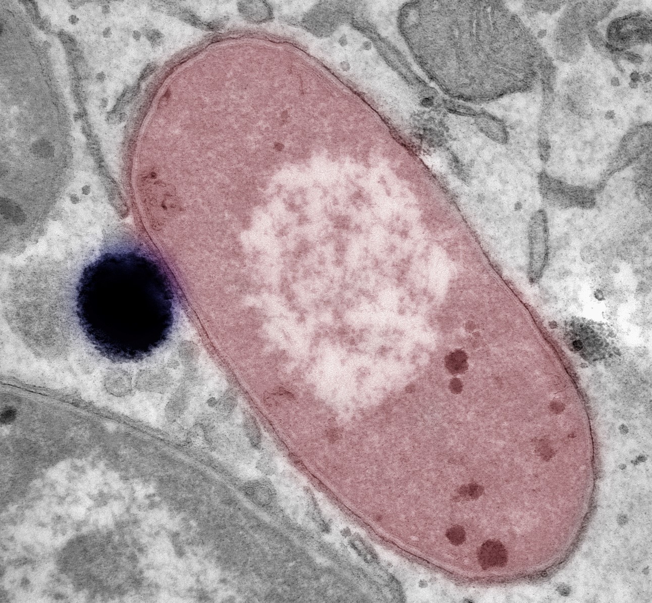 Electron microscopy image showing a lipid droplet (pseudocoloured purple) interacting with an invading bacterium (red)